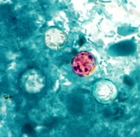 Figure 13. Oocyste de Cyclospora