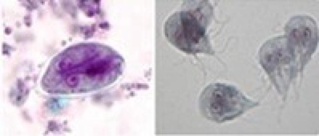 Gastrointestinal parasitic infections in immigrant and refugee children